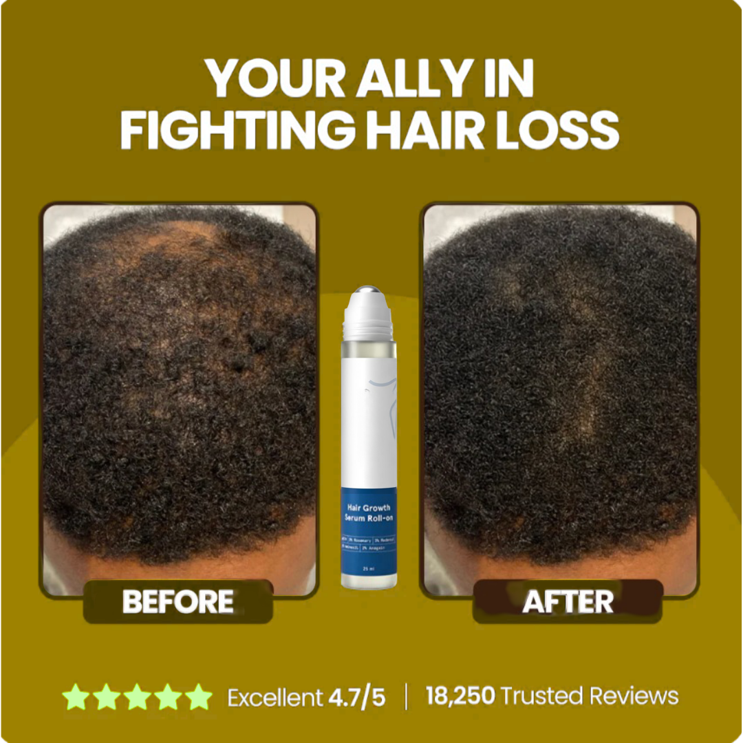 Growth Boost Roll-On Serum